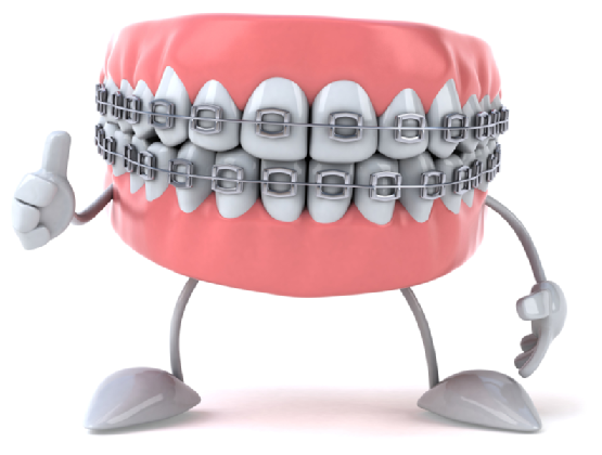 Perche l’apparecchio ai denti