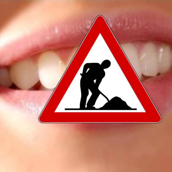 Perchè sottoporsi alla Terapia Implantare presso il Nostro Studio ?