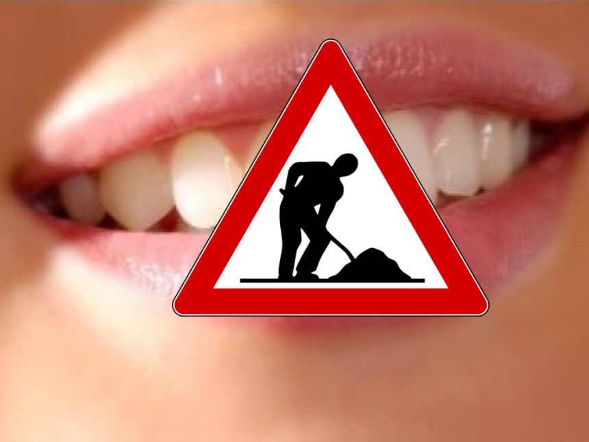 Perchè sottoporsi alla Terapia Implantare presso il Nostro Studio ?