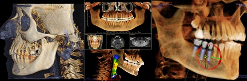 Dentascan Dentascan