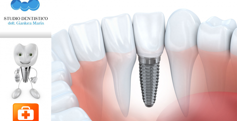 Hai perso o stai per perdere un dente?