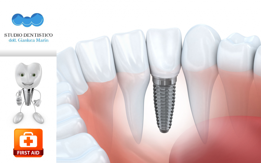 Hai perso o stai per perdere un dente? Hai perso o stai per perdere un dente?